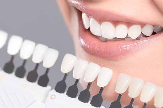 Teeth Whitening Manchester